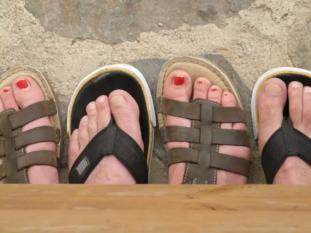 The Top Benefits of Wearing Sandals for People with Bunions